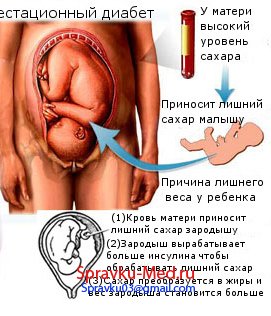 Купить справку о беременности в кратчайшие сроки